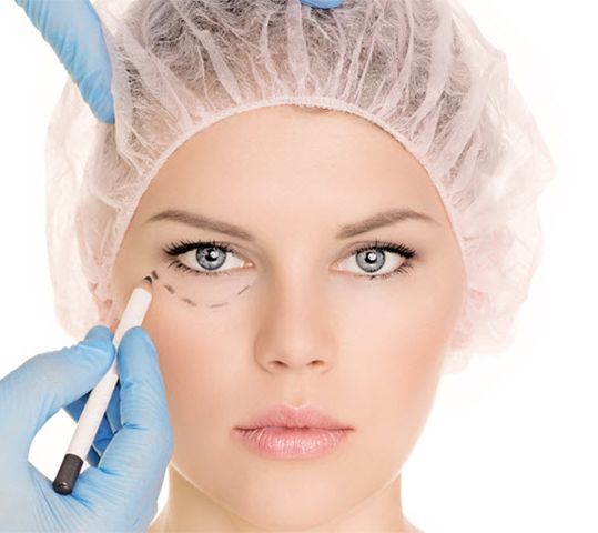 Blefaroplastia - Doctora Mayra Vigo - Cirujano Plástico.